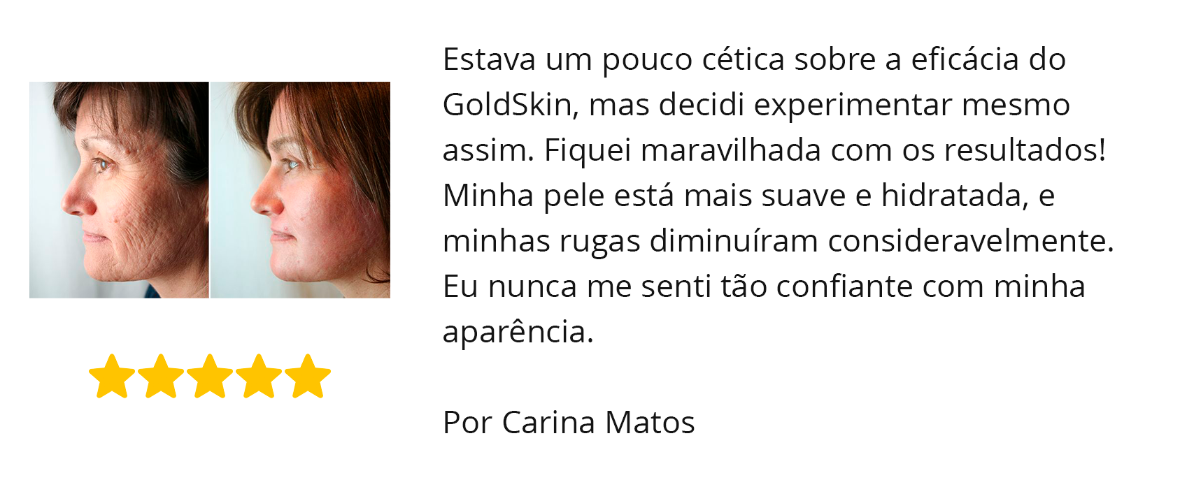 depoimento1goldskin